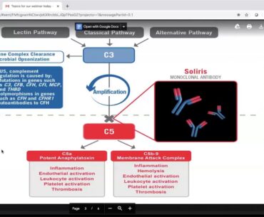 Stroke and Covid-19: Discussion with Neurologist, Dr. Tom Pitts - Part II