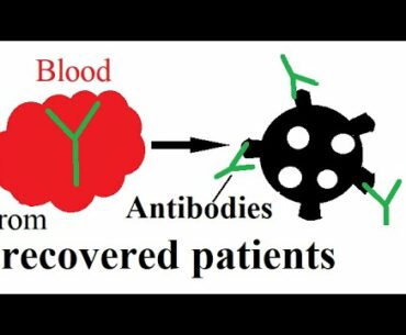 Enormous promise for coronavirus: Antibodies from recovered patients’ blood