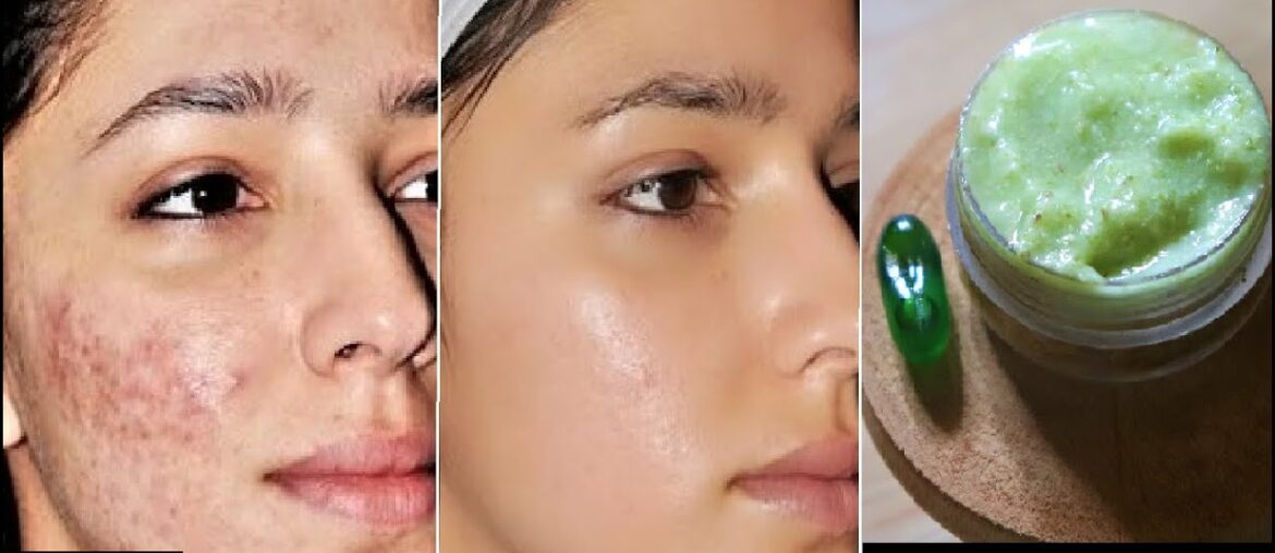 Doctors are SHOCKED! This Aloevera Face Gel Removes Dark Spots in 3 Days - Vitamin E Oil Skin Serum