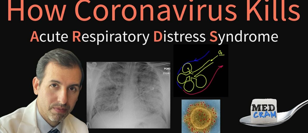 How Coronavirus Kills: Acute Respiratory Distress Syndrome (ARDS) & COVID-19 Treatment