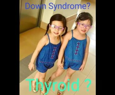 Nutritional support for the thyroid support should be a priority in Down syndrome.