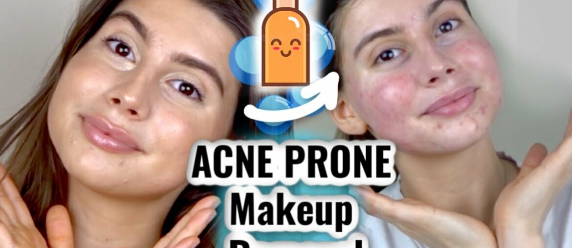 HOW I REMOVE MY MAKEUP FOR ACNE PRONE SKIN || 2 STEP PROCESS & sensitive skin friendly!!