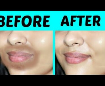 Remove Pigmentation around Mouth or Lips in overnight ,100% working remedy