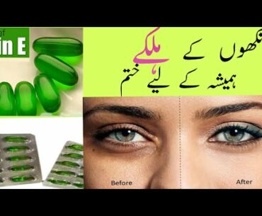 Remove Dark Circles in 5 days with Vitamin- E (100% Works)