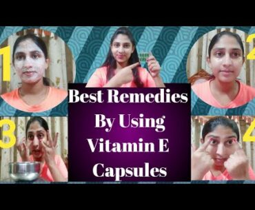 Natural Skin Glowing | Home Made Remedi | Vitamin E Capsules | FacePack | Under Eye | SimpleSoujanya