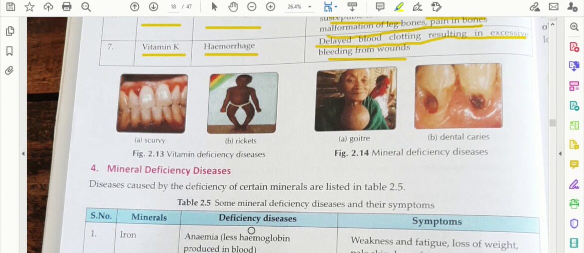 Components of food  vitamin and minerals deficiency diseases chapter end