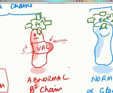 COVID-19 Insights: Sickle Cell, Thalassemia, Hemophilia