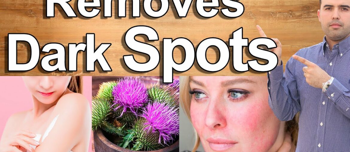 HOW TO ELIMINATE DARK SPOTS AND SUN SPOTS - Get Rid of Dark Spots and Lighten Your Skin Naturally