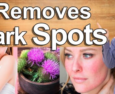 HOW TO ELIMINATE DARK SPOTS AND SUN SPOTS - Get Rid of Dark Spots and Lighten Your Skin Naturally