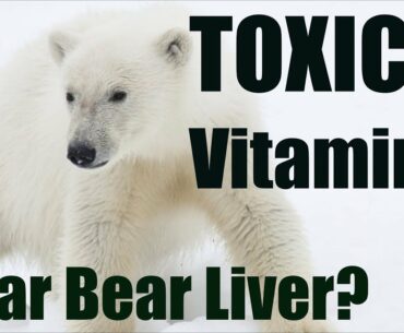 Vitamin A Toxicity from Liver? Hypervitaminosis A