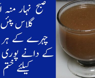 How To Get Rid Of Acne Pimples Permanently From Acne Drink | beauty tips for face