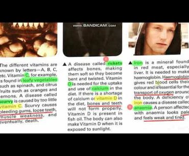 Class: 7th   Ch#5    Fit and healthy (Vitamin and mineral deficiency|)