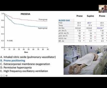 COVID-19 Critical Care Training Forum: Episode 5 - May 12, 2020