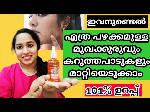 Vitamin C Serum For Face/Skin Care EP:7/Dr. rashel/