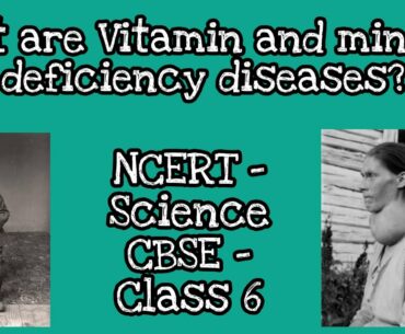 Components of food (Part-7) - Vitamin and Mineral deficiency diseases - Science NCERT class 6- CBSE