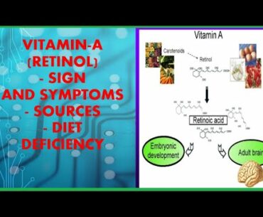 VITAMIN- A || NIGHT BLINDNESS || DIET RECOMMENDATION || SOURCE OF VITAMIN -A