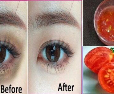 Vitamin E Tomato Remove Dark Circles , spotless skin,  Dark Spots l LuckLin Beauty