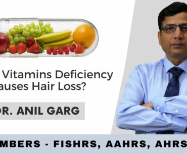 Which Vitamins Deficiency Causes Hair Loss?  Dr. Anil Garg