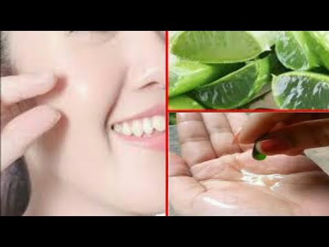 skin whitening Magic overnight with vitamin e oil and aloevera gel...skin whitening night cream...