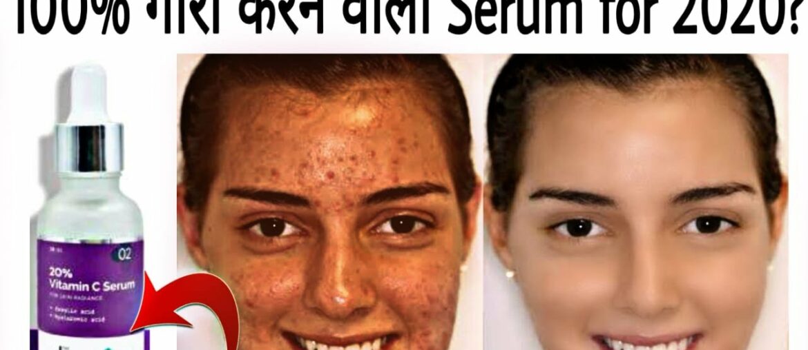 The Derma Co Vitamin C Serum Demo & Review | Serum For Acne Pimple Marks, Pigmentation, Glowing Skin