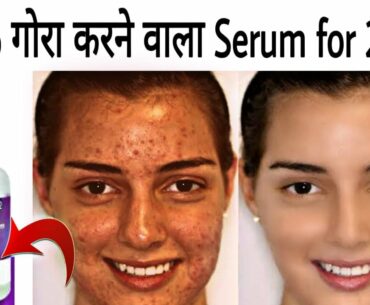 The Derma Co Vitamin C Serum Demo & Review | Serum For Acne Pimple Marks, Pigmentation, Glowing Skin