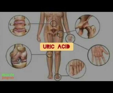 What is uric acid and how to control it ?