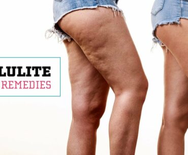 How To Get Rid Of Cellulite Naturally | Glamrs Skin Care