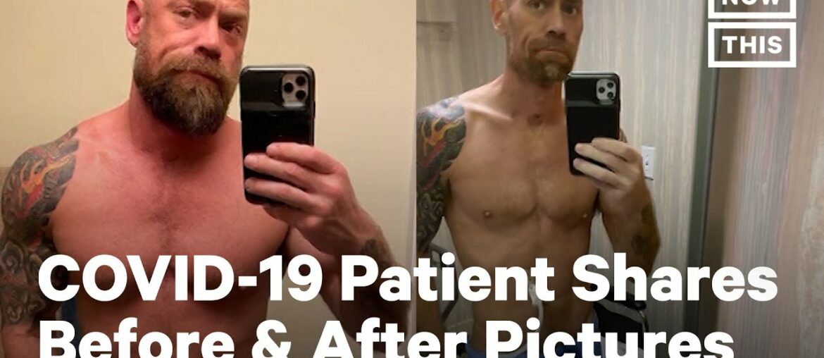 Battling COVID-19: Before and After Pictures | NowThis