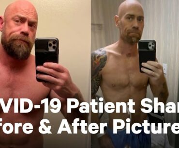 Battling COVID-19: Before and After Pictures | NowThis