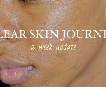 CLEAR SKIN JOURNEY I Vitamins for 30 Days I 2 Week UPDATE (WITH PICTURES)