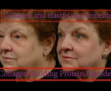 Collagen and elastin supplements.Collagen Building Protein Peptides