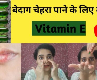 Evion Vitamin E Capsule Uses, Side Effects Ingredients & How To Use In Hindi