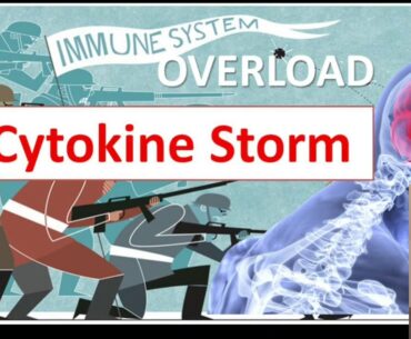 Cytokine Storm, immune system overactive and its relation to coronavirus patents death