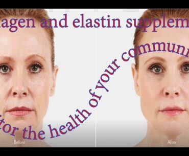 Collagen and elastin supplements. Monitor the health of your community here