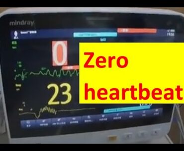 12 rules for Corona: Avoid zero heartbeat. What stupid people do - what smart engineers understand.