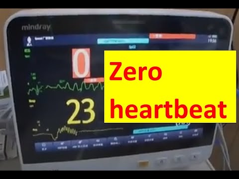 12 rules for Corona: Avoid zero heartbeat. What stupid people do - what smart engineers understand.