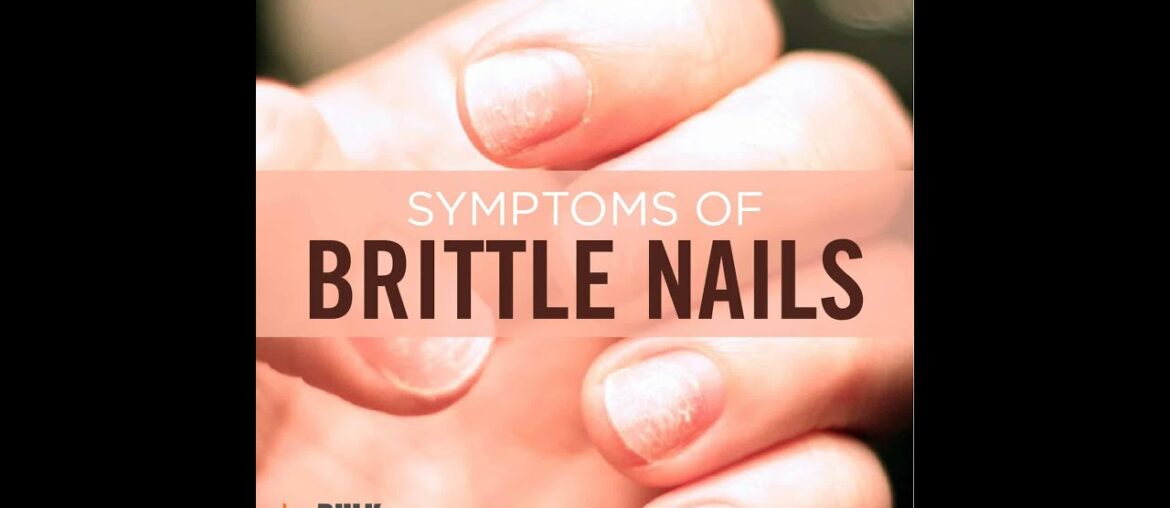 Brittle Nails - what causes brittle nails - what vitamin are you lacking if your nails are brittle