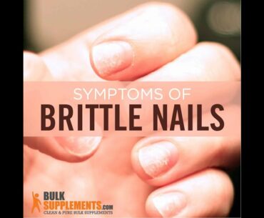 Brittle Nails - what causes brittle nails - what vitamin are you lacking if your nails are brittle