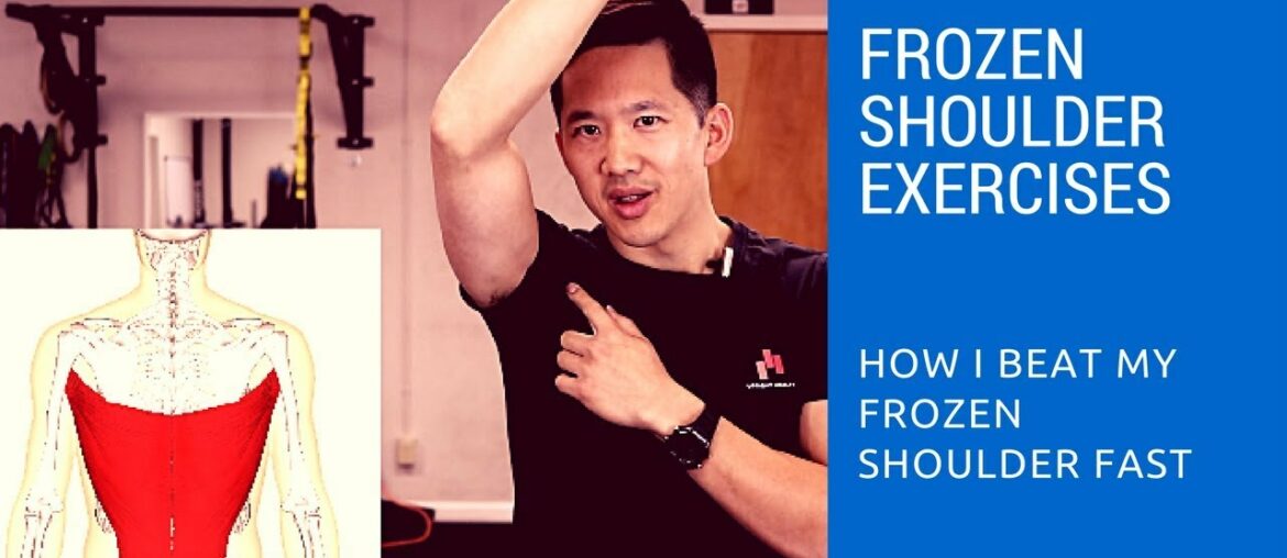 Frozen shoulder exercises - how I got relief in just two days