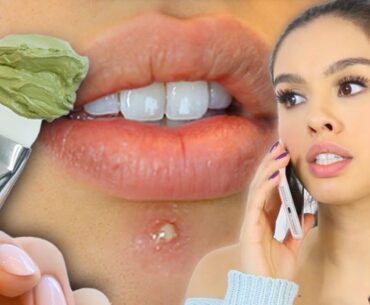 10 SKINCARE MISTAKES YOU'RE MAKING *life changing*