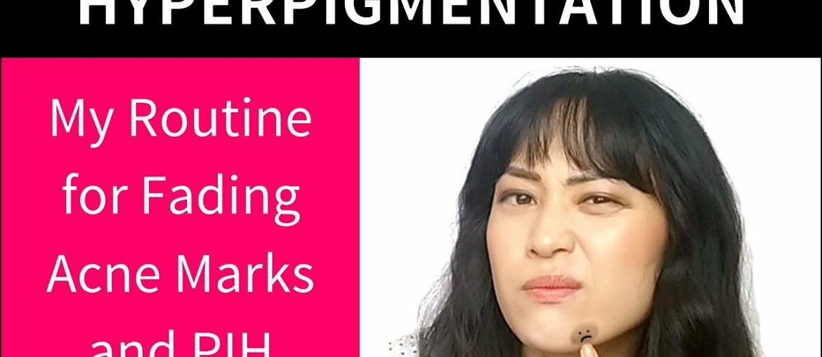 My Routine for Fading Acne Marks (Post-Inflammatory Hyperpigmentation) | Lab Muffin Beauty Science