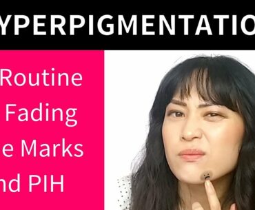 My Routine for Fading Acne Marks (Post-Inflammatory Hyperpigmentation) | Lab Muffin Beauty Science