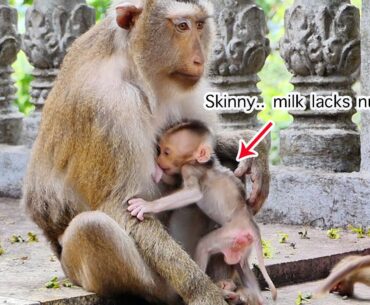 Exactly pity!! Skinny baby of Stephanie seems get milk lacks nutrients (vitamins) from mother #1765