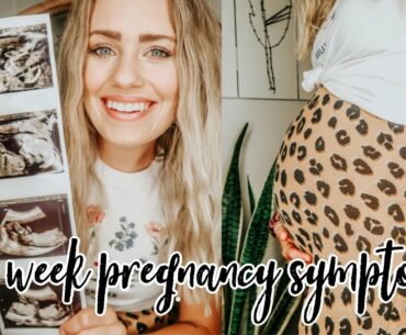 20 WEEK PREGNANCY UPDATE|| ANATOMY SCAN|| WEIGHT GAIN|| SUPPLEMENTS I AM TAKING|| HAYLEY JANNISE