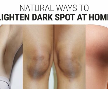 How To Lighten Dark Underarms, Knees & Elbows | Skin Brightening Tips for Dark Spot