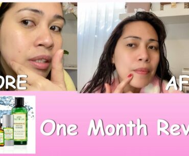 How to get rid of dark spots? | Tree of life beauty: Vitamin C review!