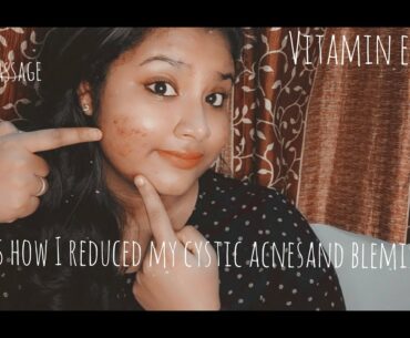 VITAMIN E OIL - BENEFITS, USAGE | REDUCE ACNE, PIGMENTATION USING THIS REMEDY - MALAYALAM BEAUTY TIP