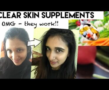 5 BEST SUPPLEMENTS FOR PERFECTLY CLEAR ACNE FREE SKIN!