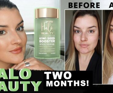 CLEARING MY SKIN IN 2 MONTHS | Halo Beauty Supplements + Treating Hormonal Acne