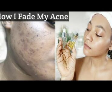 Get rid of Hyperpigmentation and Acne With Breylee Vitamin C Skin White+Breylee Snail Repair Serum